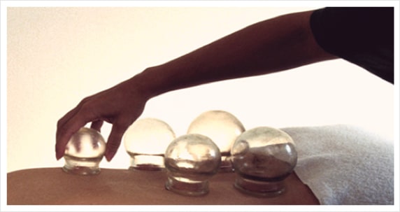 Fire Cupping